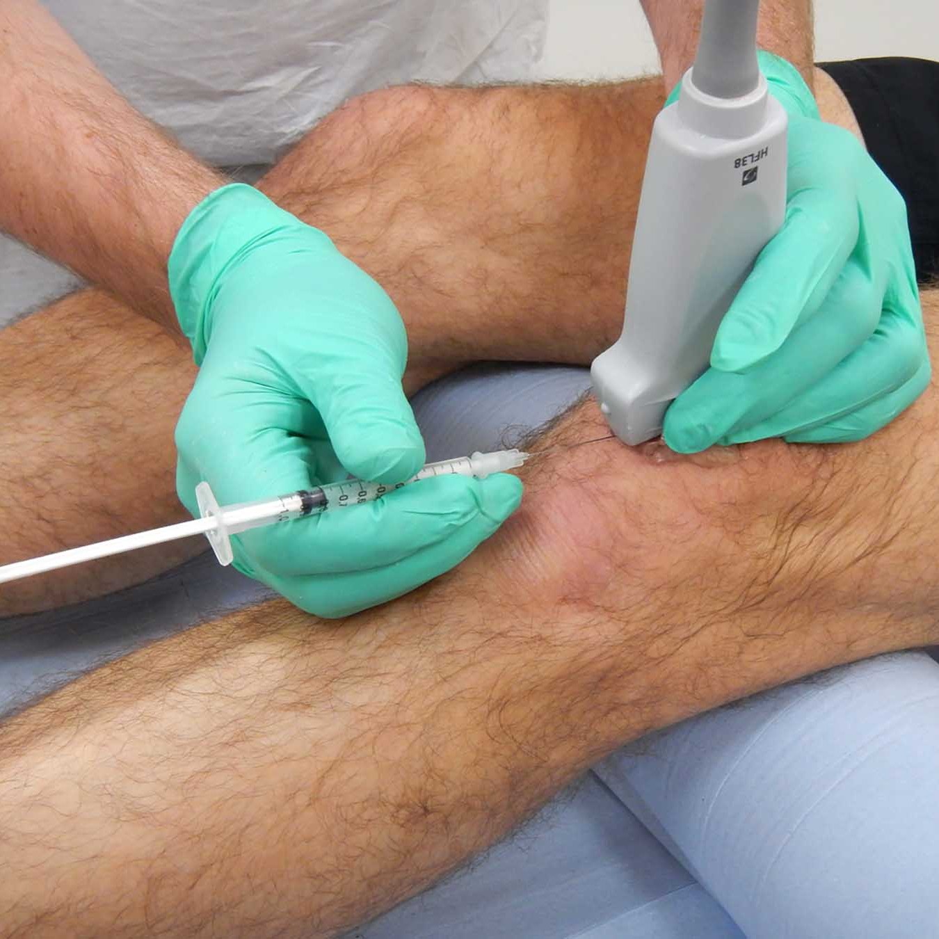 Cortisone Injection knee