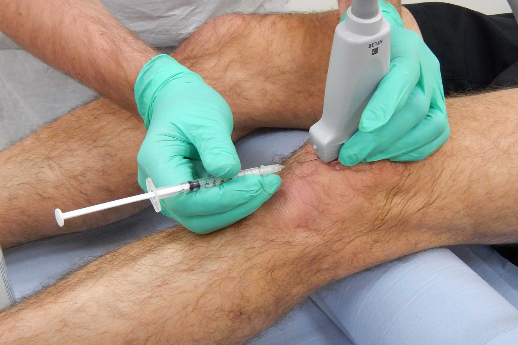 Cortisone Injection knee