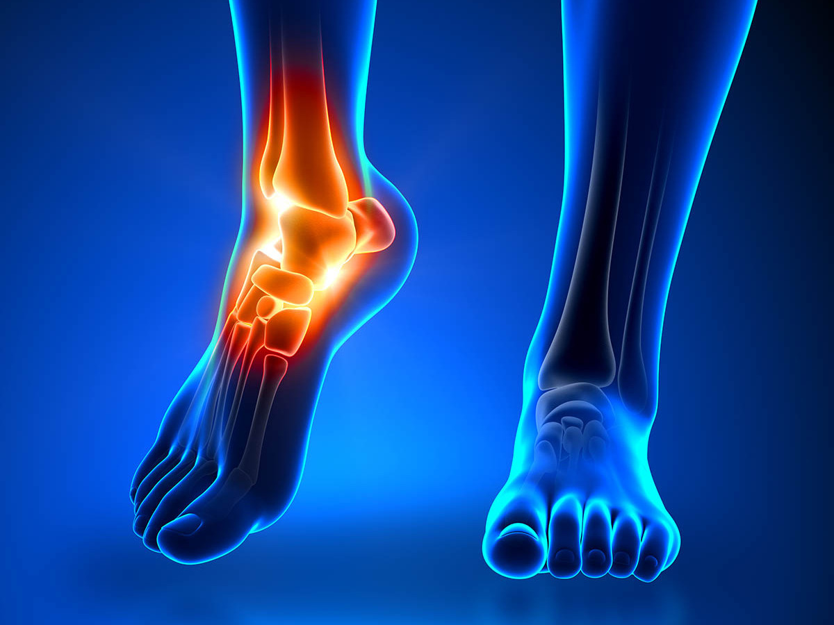 Ankle joint 1 Ankle Joint pain illustration