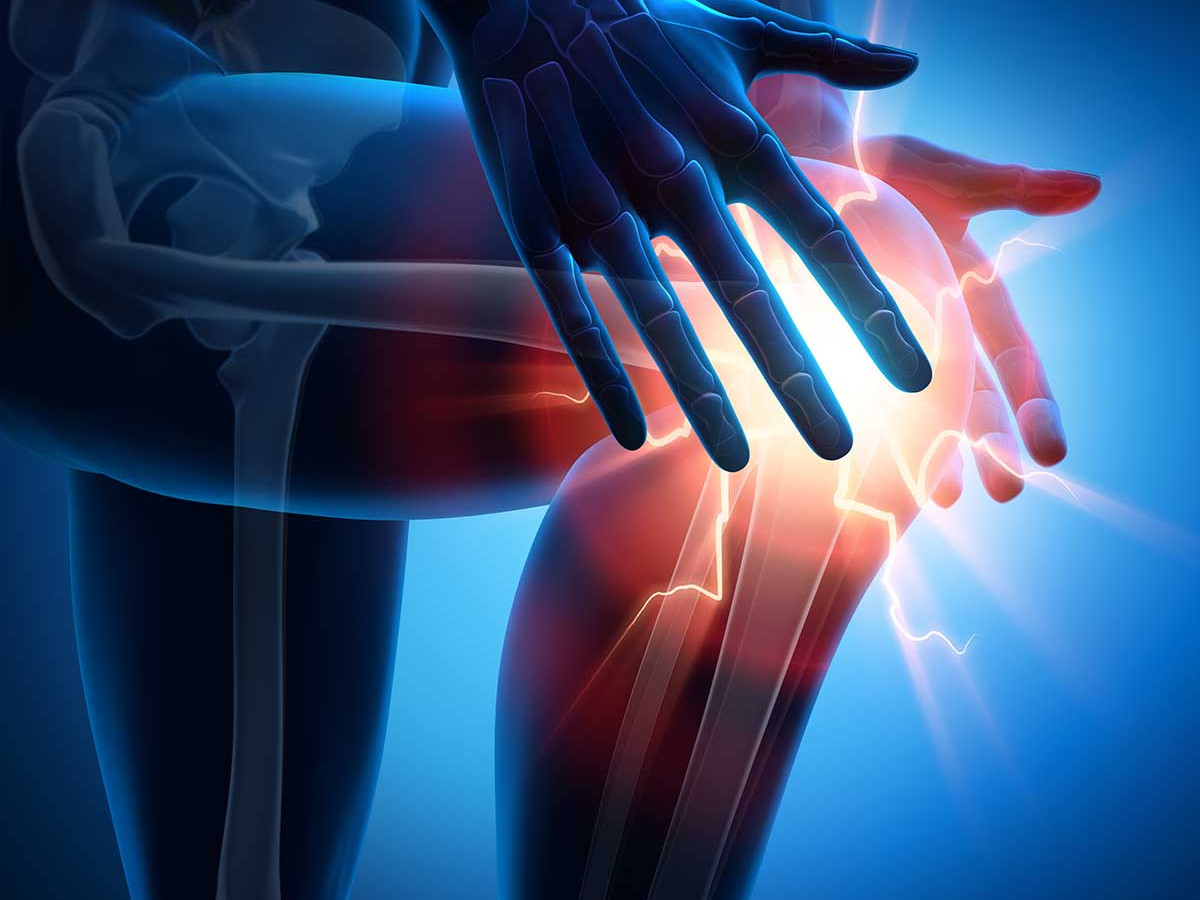 illustration of Knee Joint pain