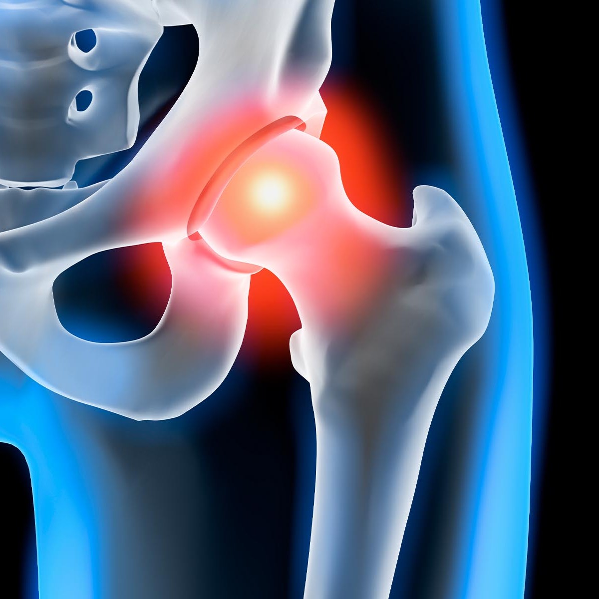 ultrasound guided hip injection