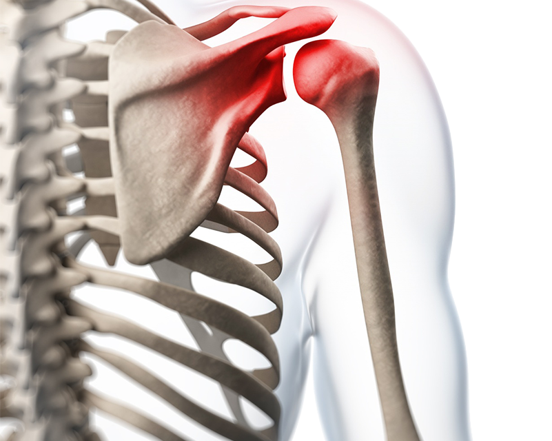 Frozen Shoulder Sonoscope 1 Frozen Shoulder skeletal illustration