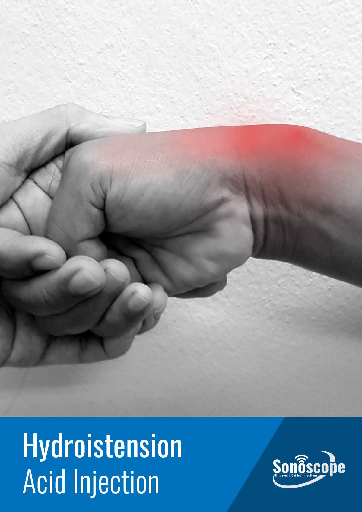 hydroistension acid injection : Radiocarpal Joint Pain