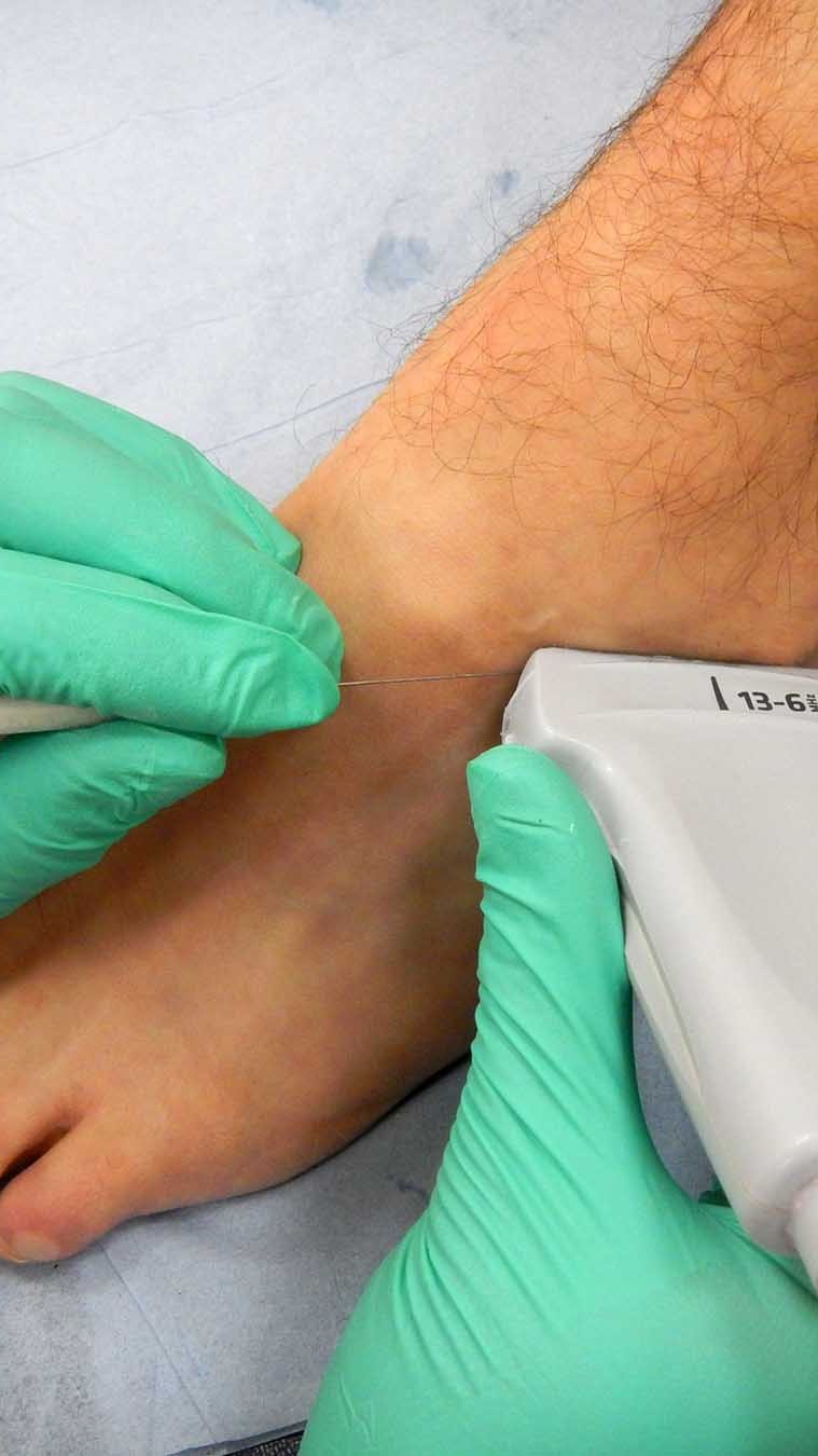 Sonoscope Acid Injection 1 Cortisone Injection ankle