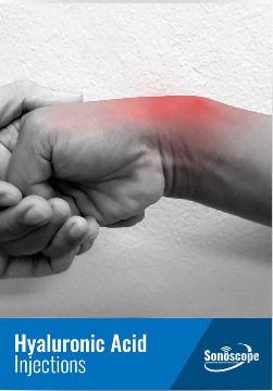 HYALURONIC ACID INJECTIONS 4 Hyaluronic acid injections information leaflet