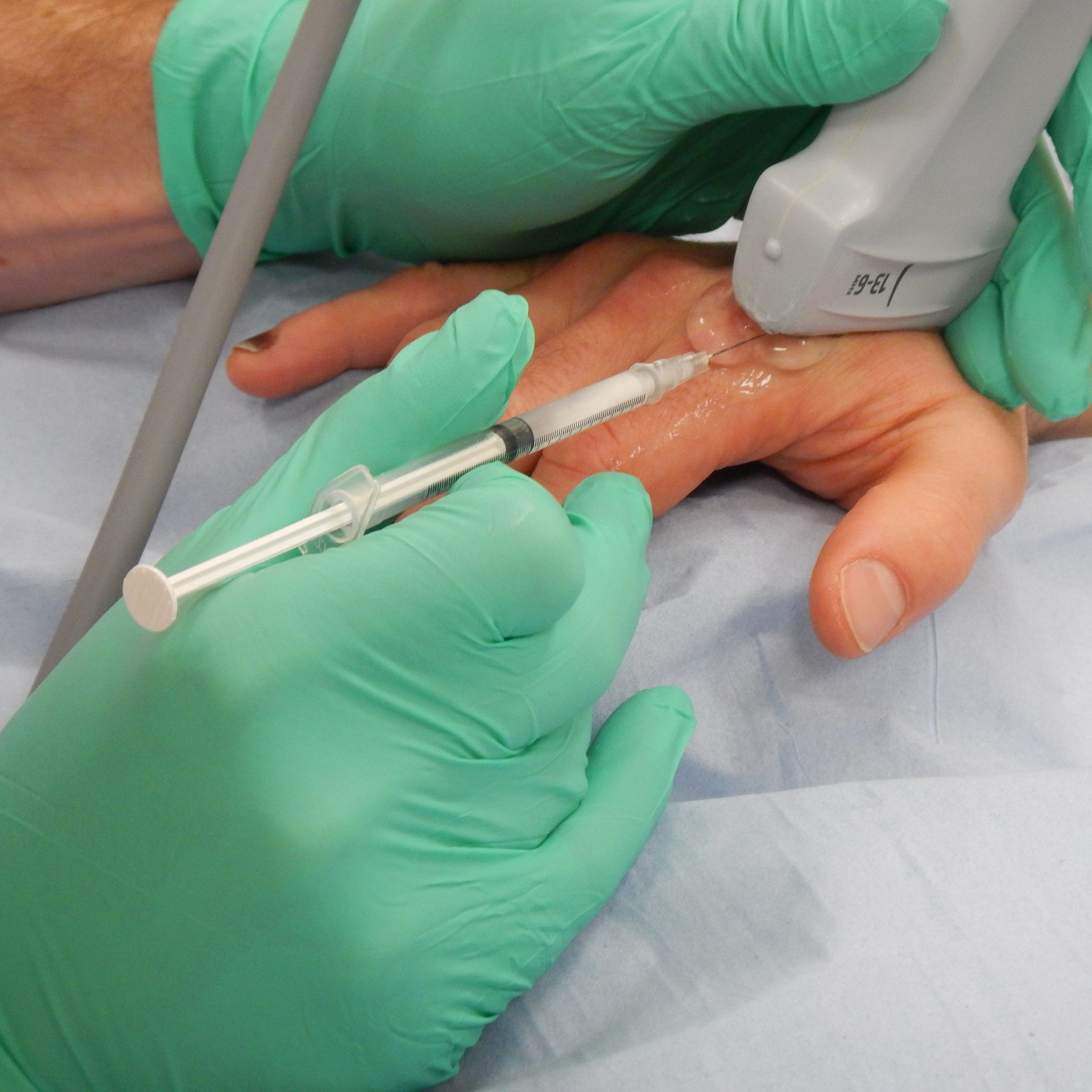 MCPJ INJECTION ultrasound guided