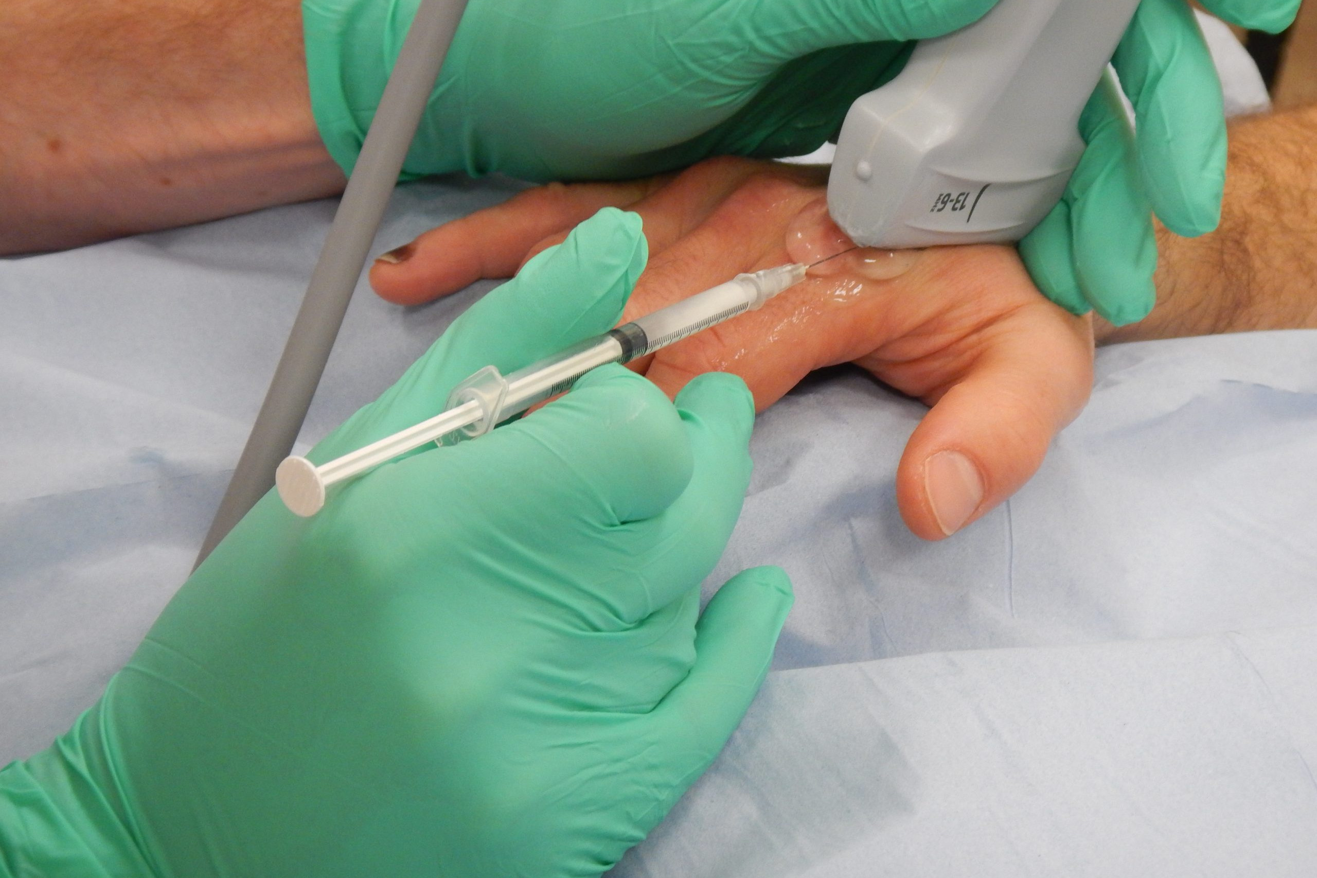 MCPJ INJECTION ultrasound guided