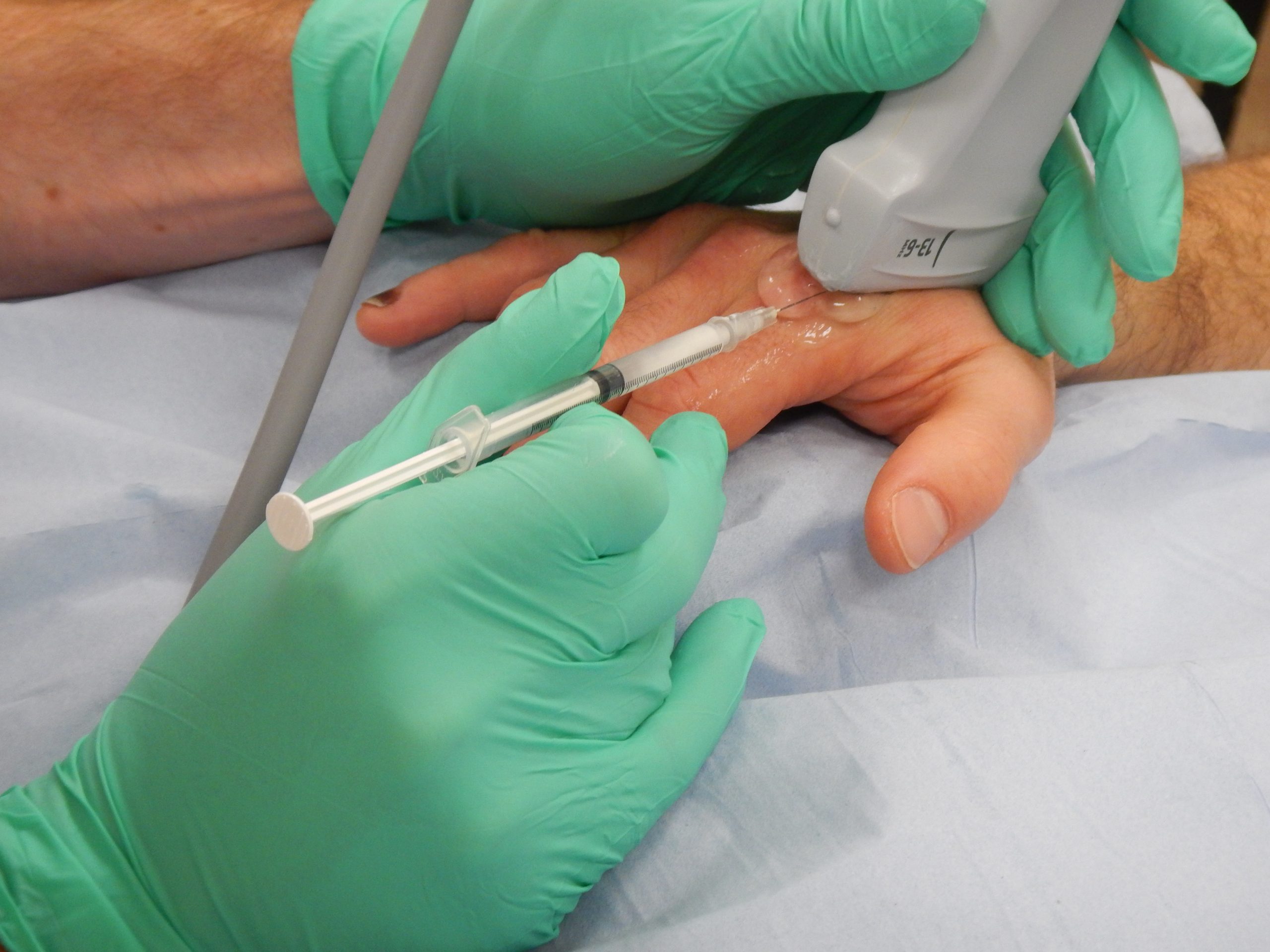 MCPJ INJECTION ultrasound guided