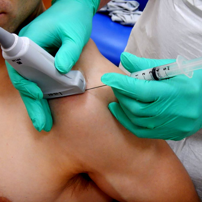 a patient is having an ultrasound guided injection in the sonoscope pain clinic