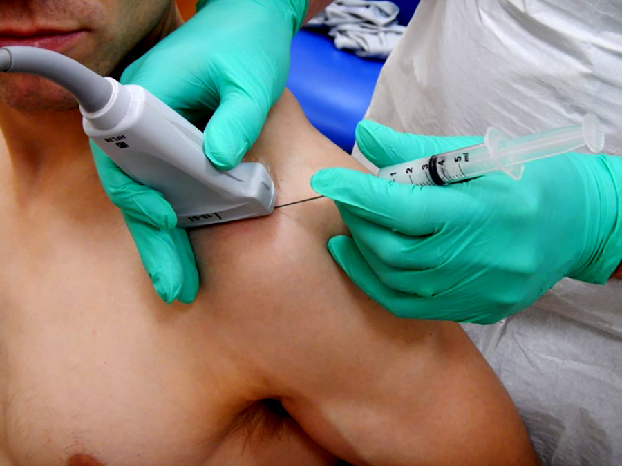 a patient is having an ultrasound guided injection in the sonoscope pain clinic