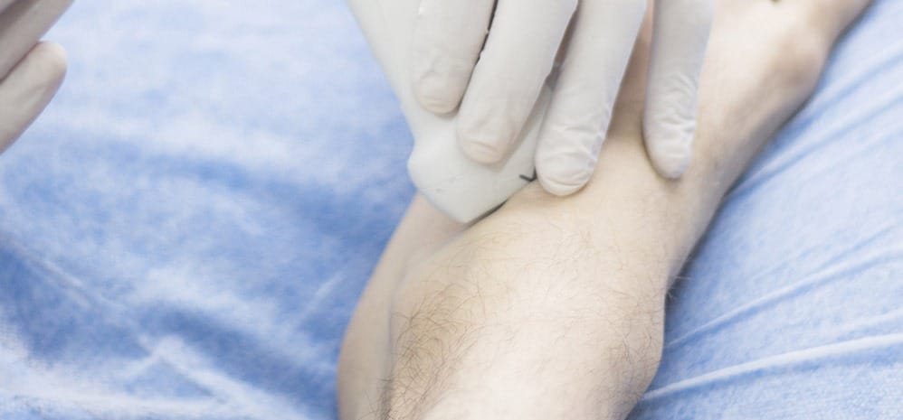 Hyaluronic acid injection for knee, Hyaluronic acid injections knee cost uk, Cortisone injection cost, Shoulder steroid injection, Private cortisone injections near me, Arthrosamid injection uk price, Arthrosamid cost, Private cortisone injections near me