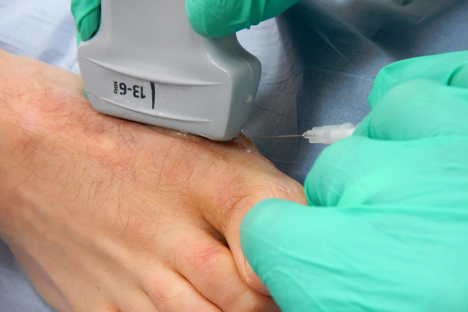 Cortisone Injections for Osteoarthritis 9 Hyaluronic acid injection for knee, Hyaluronic acid injections knee cost uk, Cortisone injection cost, Shoulder steroid injection, Private cortisone injections near me, Arthrosamid injection uk price, Arthrosamid cost, Private cortisone injections near me