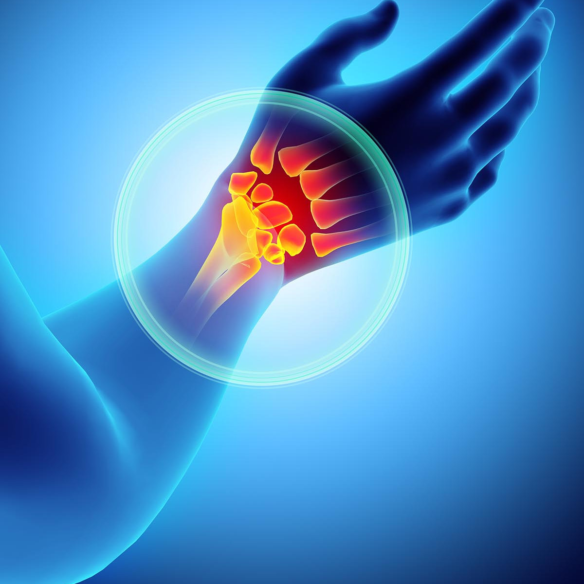 Hyaluronic acid injection for knee, Hyaluronic acid injections knee cost uk, Cortisone injection cost, Shoulder steroid injection, Private cortisone injections near me, Arthrosamid injection uk price, Arthrosamid cost, Private cortisone injections near me