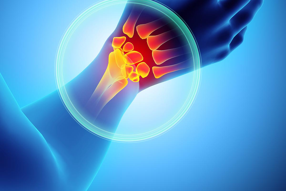 Carpal tunnel syndrome- is steroid injection helpful? 4 Hyaluronic acid injection for knee, Hyaluronic acid injections knee cost uk, Cortisone injection cost, Shoulder steroid injection, Private cortisone injections near me, Arthrosamid injection uk price, Arthrosamid cost, Private cortisone injections near me