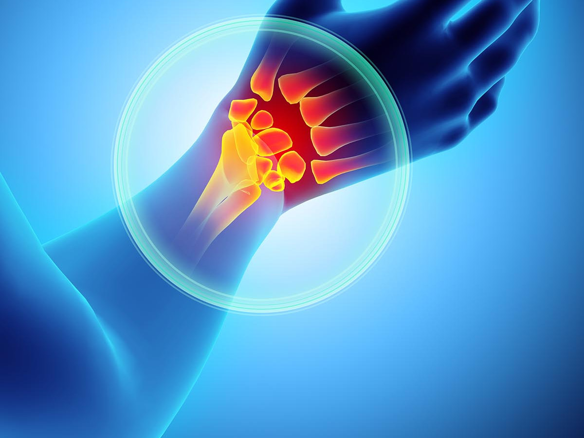 Hyaluronic acid injection for knee, Hyaluronic acid injections knee cost uk, Cortisone injection cost, Shoulder steroid injection, Private cortisone injections near me, Arthrosamid injection uk price, Arthrosamid cost, Private cortisone injections near me