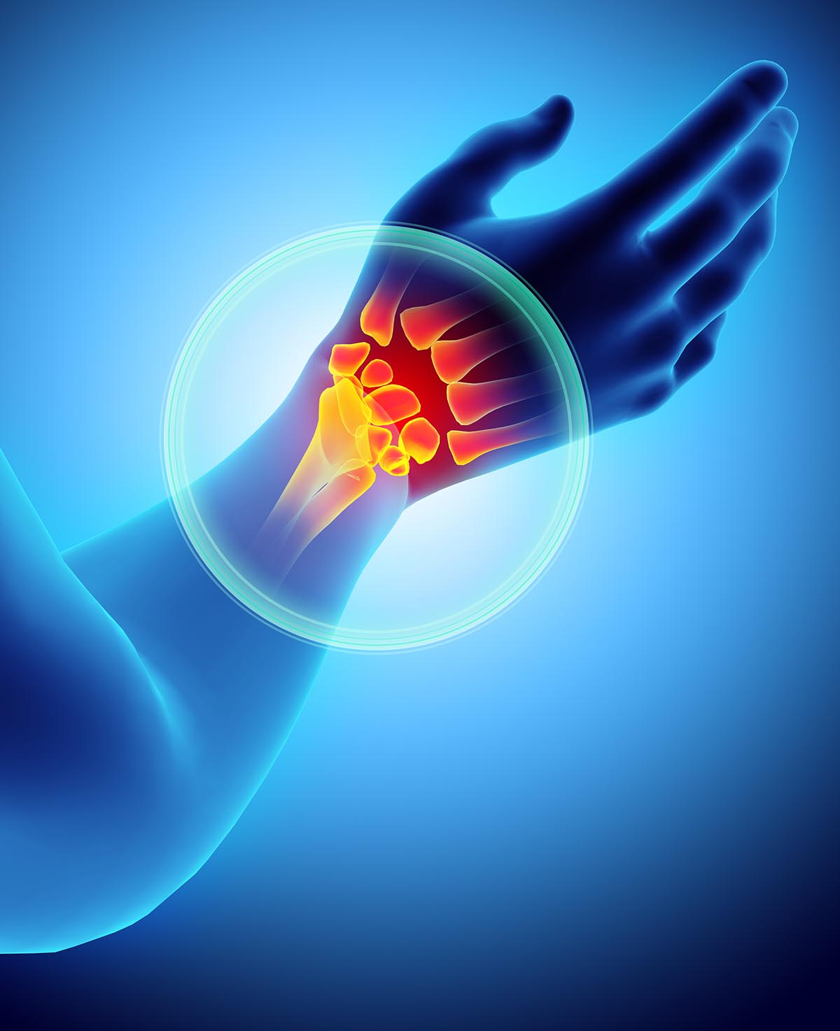 Hyaluronic acid injection for knee, Hyaluronic acid injections knee cost uk, Cortisone injection cost, Shoulder steroid injection, Private cortisone injections near me, Arthrosamid injection uk price, Arthrosamid cost, Private cortisone injections near me