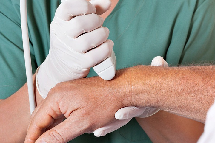 Hyaluronic acid injection for knee, Hyaluronic acid injections knee cost uk, Cortisone injection cost, Shoulder steroid injection, Private cortisone injections near me, Arthrosamid injection uk price, Arthrosamid cost, Private cortisone injections near me