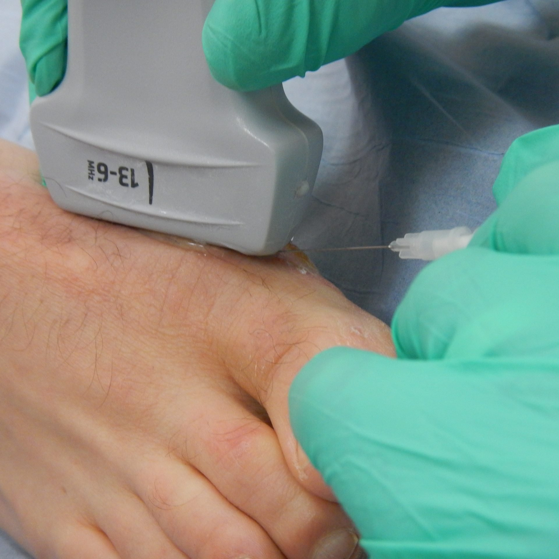 Steroid injection Kenalog, Price of steroid injection, Ultrasound injections, Achilles tendinopathy ultrasound, Fastest acting steroid, Fat dissolving injections knees