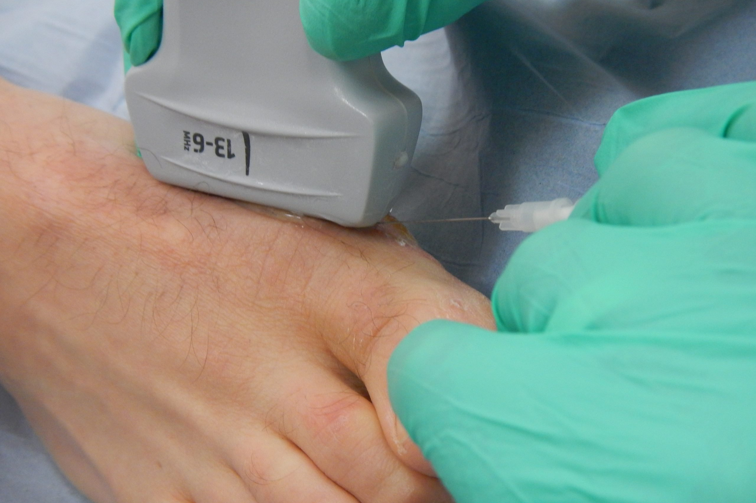 What is Advanced Practice Physiotherapy? 6 Steroid injection Kenalog, Price of steroid injection, Ultrasound injections, Achilles tendinopathy ultrasound, Fastest acting steroid, Fat dissolving injections knees