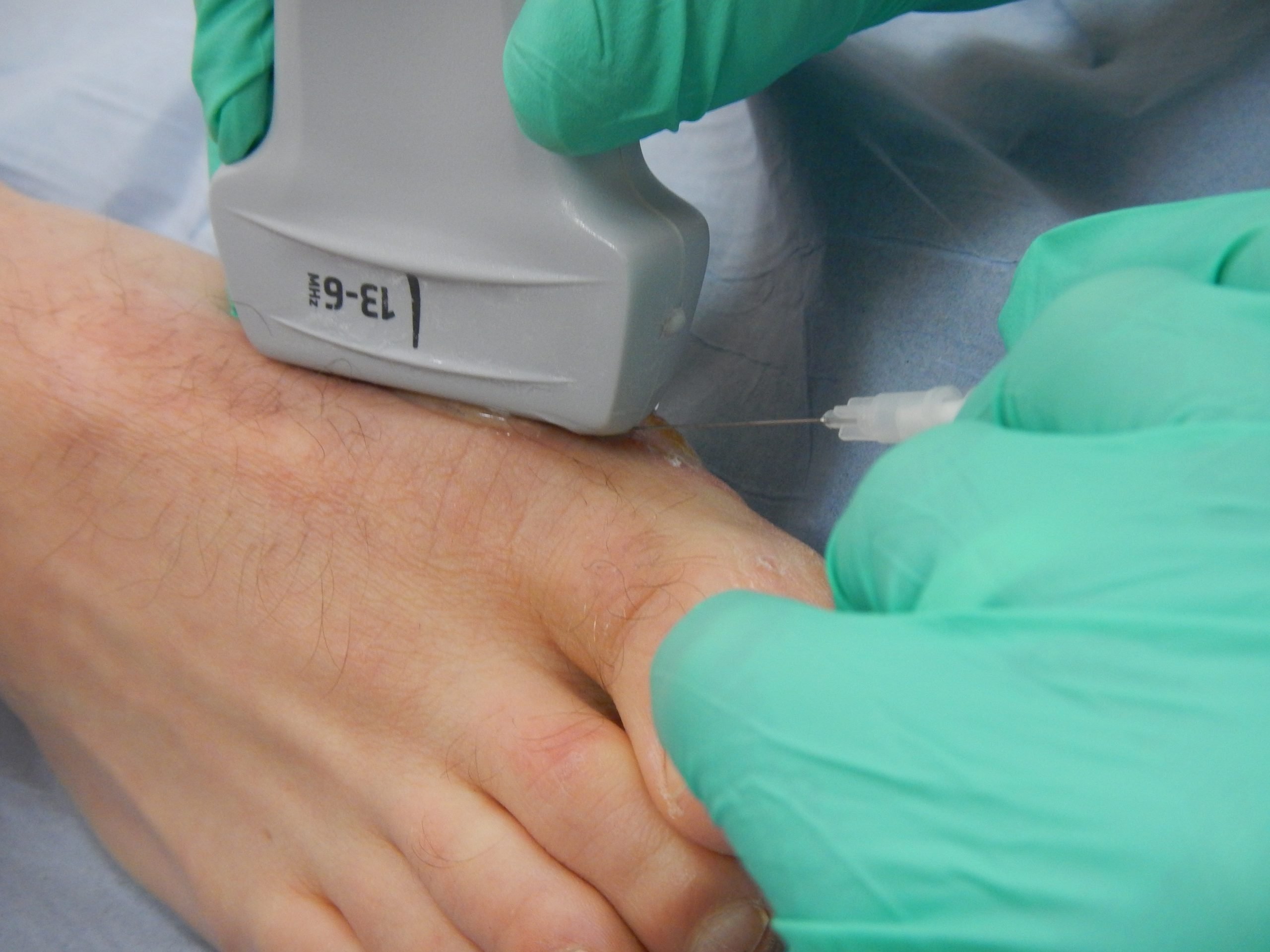 Steroid injection Kenalog, Price of steroid injection, Ultrasound injections, Achilles tendinopathy ultrasound, Fastest acting steroid, Fat dissolving injections knees