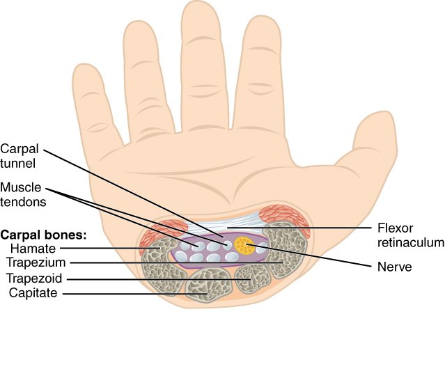 Carpal tunel graphic