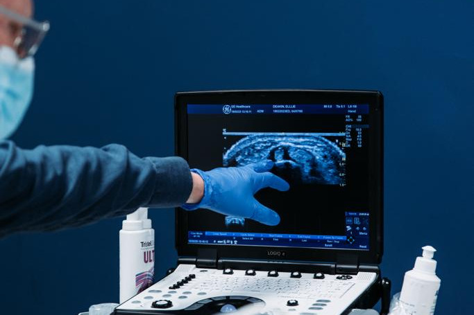 How long does an ultrasound-guided injection last for? 9 Steroid injection Kenalog, Price of steroid injection, Ultrasound injections, Achilles tendinopathy ultrasound, Fastest acting steroid, Fat dissolving injections knees