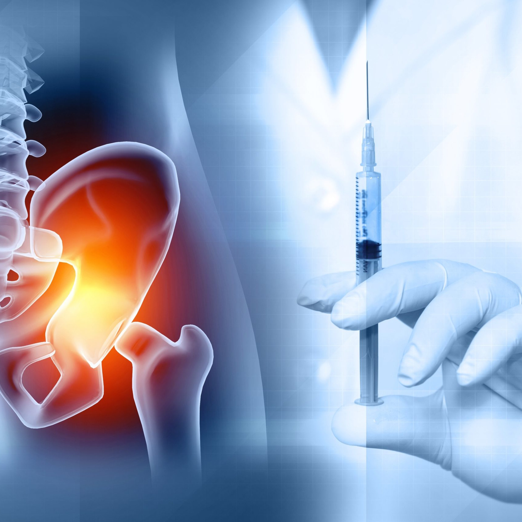 diagram of the bottom of a spine and hips with hip highlighted in different colours, someone holding up a needle
